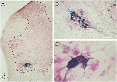 The Dual Nature of Onuf’s Nucleus: Neuroanatomical Features and Peculiarities, in Health and Disease